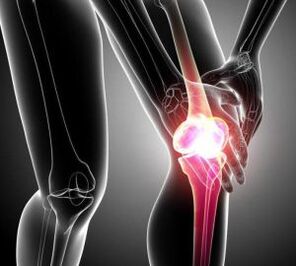 біль в колінному суглобі при артриті і артрозі