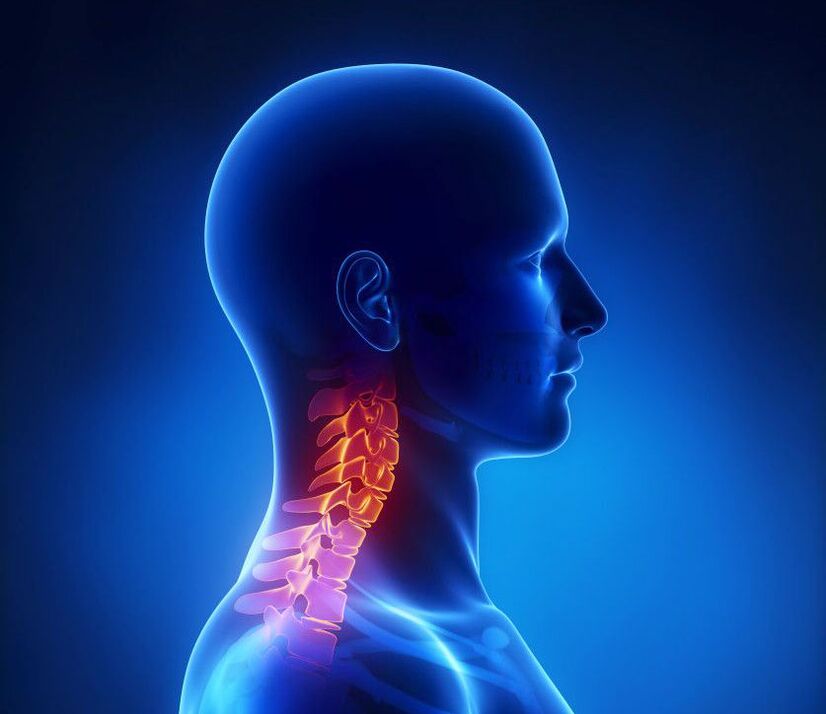 Шийний остеохондроз – патологія хребта, позбутися якої можна в домашніх умовах